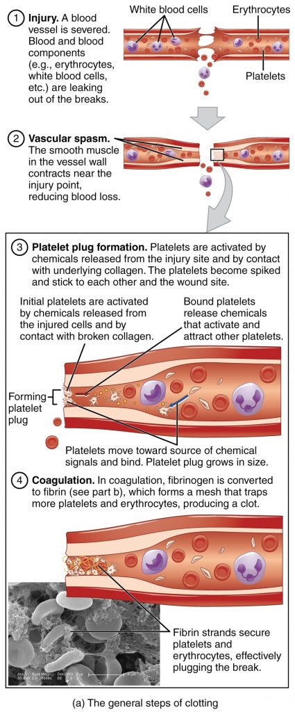 Photo of the general stages of clotting
