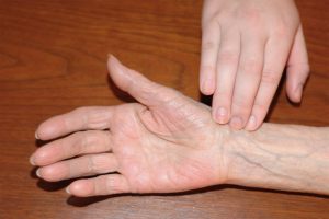 Phot showing a hand checking for the Radial Pulse on wrist