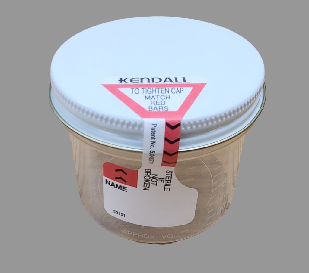 Photo showing a sterile specimen cup